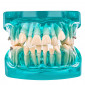 Демонстрационная модель Revyline "Зубы" с ортодонтическими имплантами
