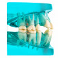 Демонстрационная модель Revyline "Зубы" с ортодонтическими имплантами