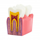 Демонстрационная модель Revyline TM-083 "Зубы в разрезе"